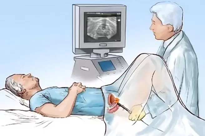 diagnóstico de prostatitis